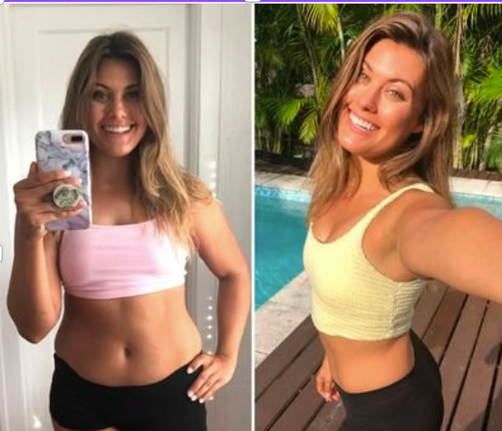 VibroSlim Anti Cellulite Massager