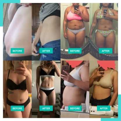 VibroSlim Anti Cellulite Massager